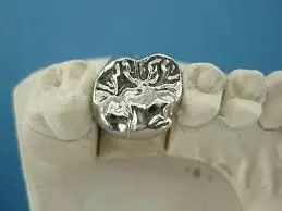 bọc răng inox